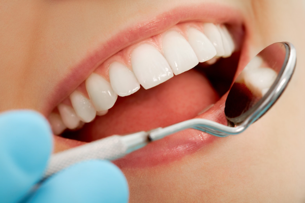 Close-up of patient's open mouth during oral checkup with mirror near by